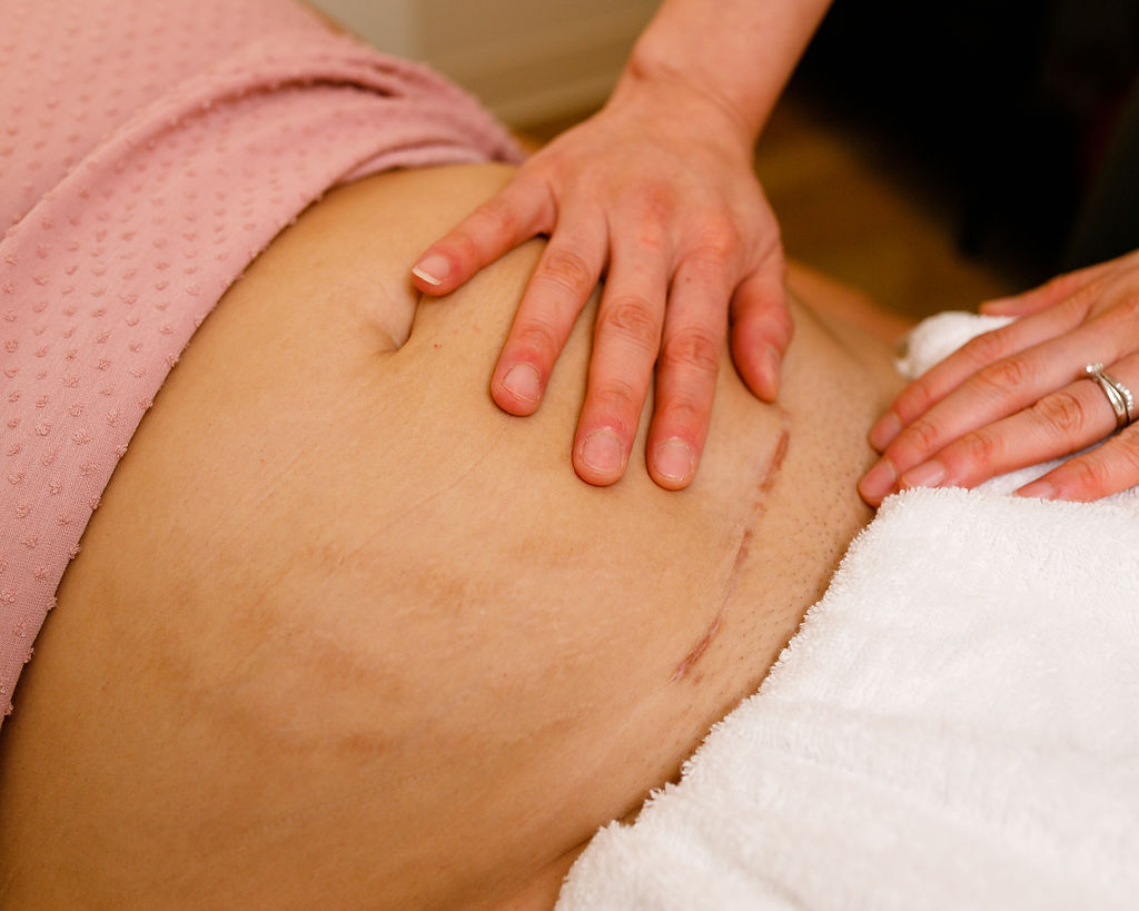 bump physio c section recovery